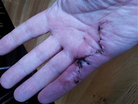 Hand Op