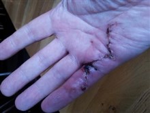 Hand Op