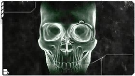 human skull xray